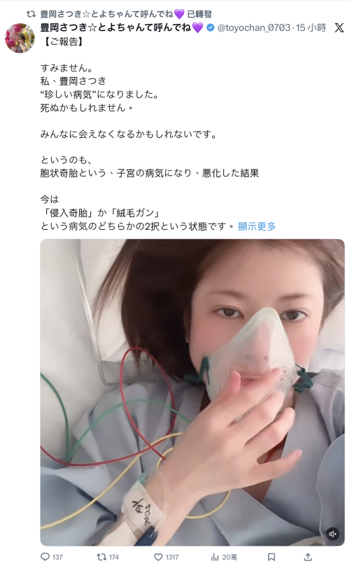 豊岡さつき(丰冈沙月)自爆罹患罕见疾病、可能致命!