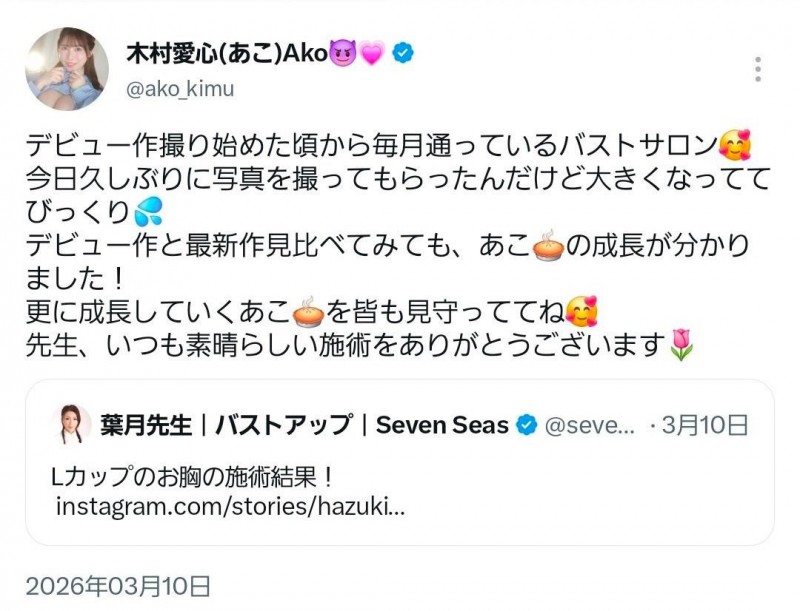 被指隆乳不忍了!木村爱心直球对决!